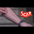 SCAR by Dan Alex - Video DOWNLOAD